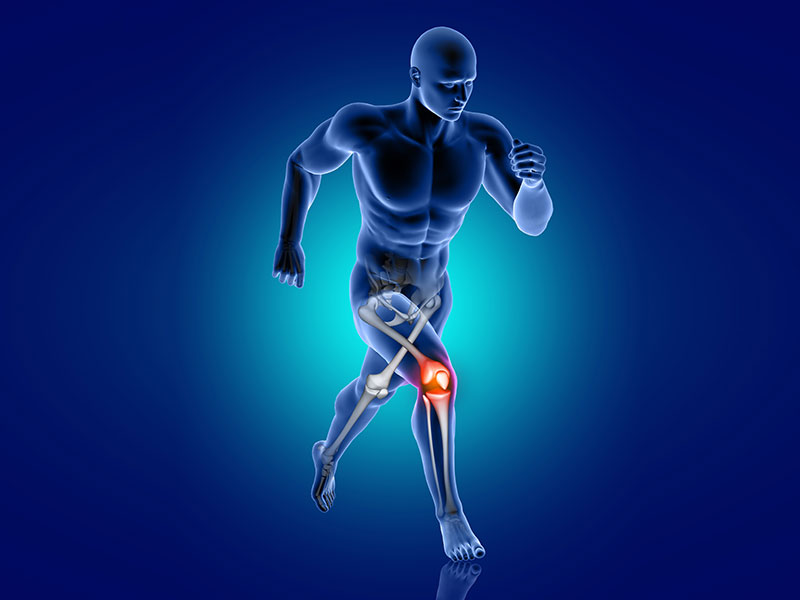 OSTEOARTRİT (OA) SEMPTOMLARI NELERDİR?